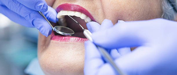 Best Emergency Treatment for Dental Infections or Abscesses in Dillon, CO